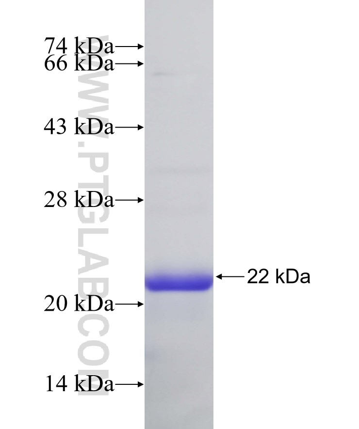 DCLK1 fusion protein Ag32019 SDS-PAGE