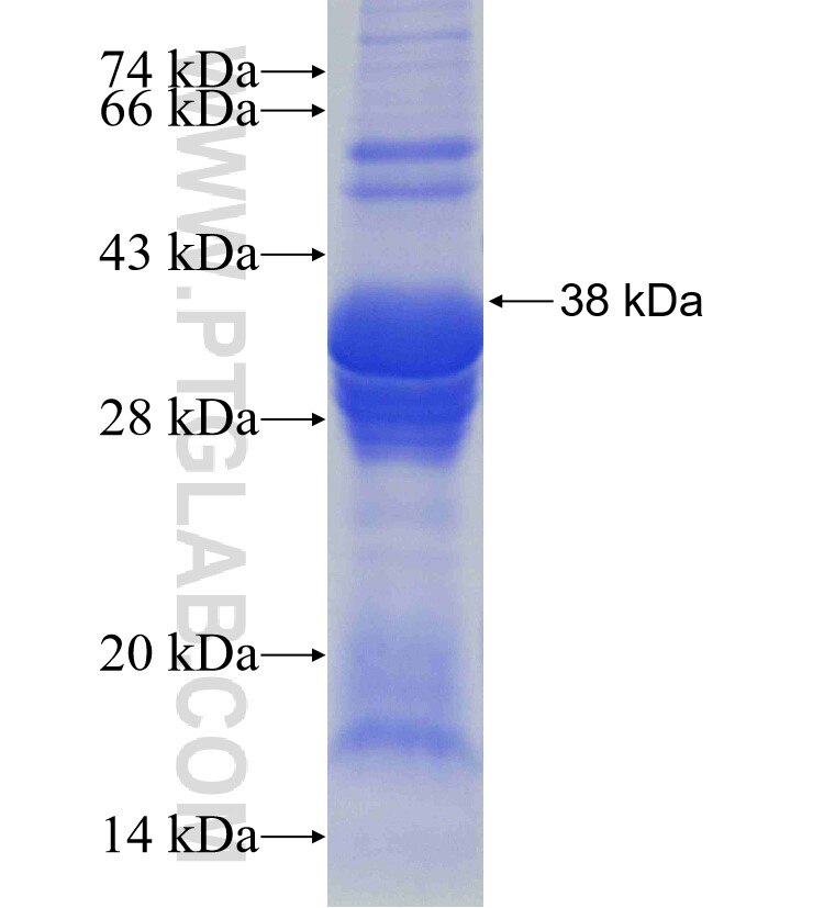 DCLK1 fusion protein Ag16292 SDS-PAGE