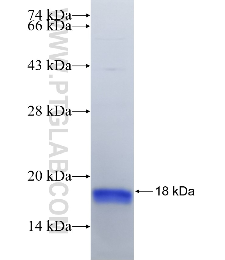 DCLK1 fusion protein Ag17110 SDS-PAGE