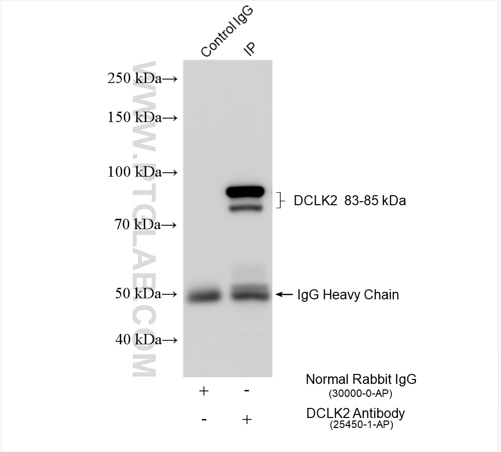 Immunoprecipitation (IP) experiment of mouse brain tissue using DCLK2 Polyclonal antibody (25450-1-AP)
