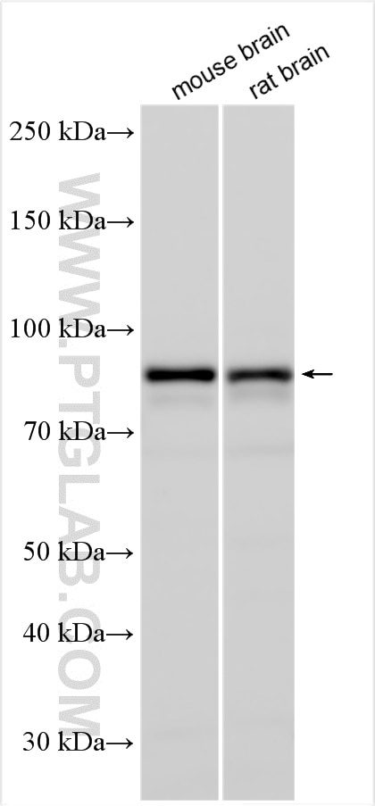 Western Blot (WB) analysis of various lysates using DCLK2 Polyclonal antibody (25450-1-AP)
