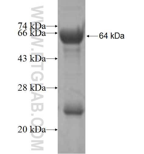 DCLRE1A fusion protein Ag5425 SDS-PAGE