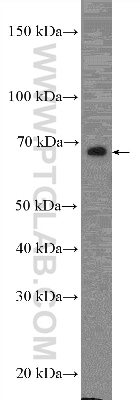 Western Blot (WB) analysis of HepG2 cells using DCLRE1B Polyclonal antibody (13203-1-AP)