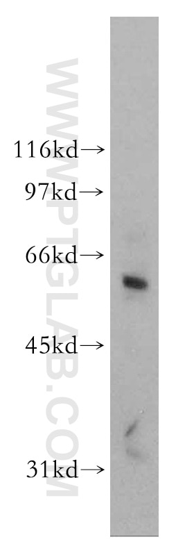 Western Blot (WB) analysis of Jurkat cells using DCLRE1B Polyclonal antibody (13203-1-AP)