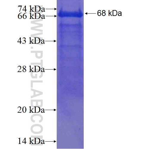 DCLRE1B fusion protein Ag3945 SDS-PAGE