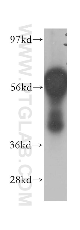 Western Blot (WB) analysis of human kidney tissue using DCLRE1C Polyclonal antibody (11747-1-AP)