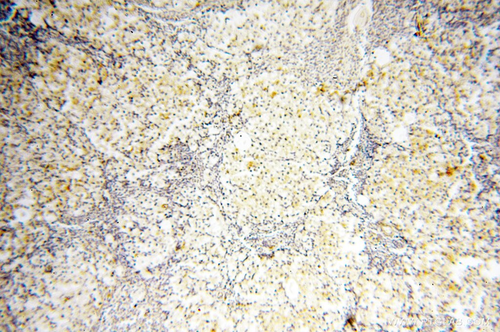 Immunohistochemistry (IHC) staining of human ovary tissue using Decorin Polyclonal antibody (14667-1-AP)