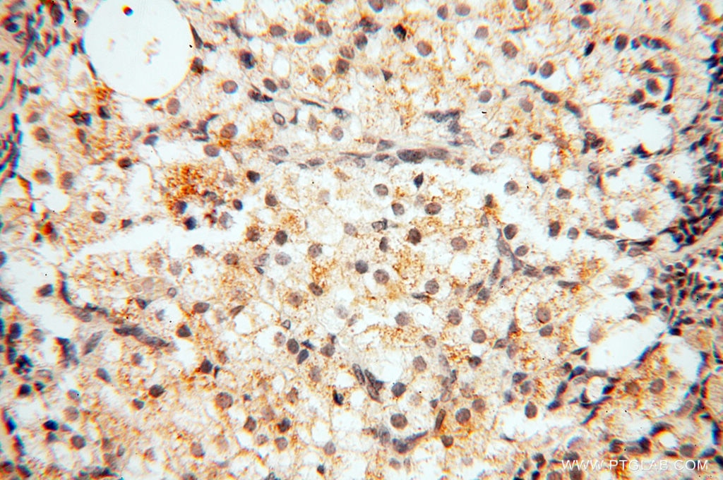 Immunohistochemistry (IHC) staining of human ovary tissue using Decorin Polyclonal antibody (14667-1-AP)