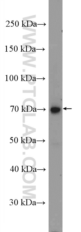 Western Blot (WB) analysis of mouse heart tissue using Decorin Polyclonal antibody (14667-1-AP)