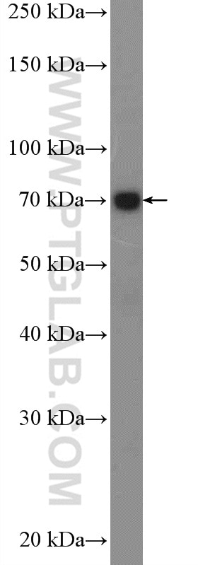 Western Blot (WB) analysis of MCF-7 cells using Decorin Polyclonal antibody (14667-1-AP)