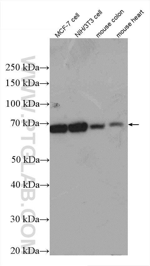 WB analysis of MCF-7 using 14667-1-AP