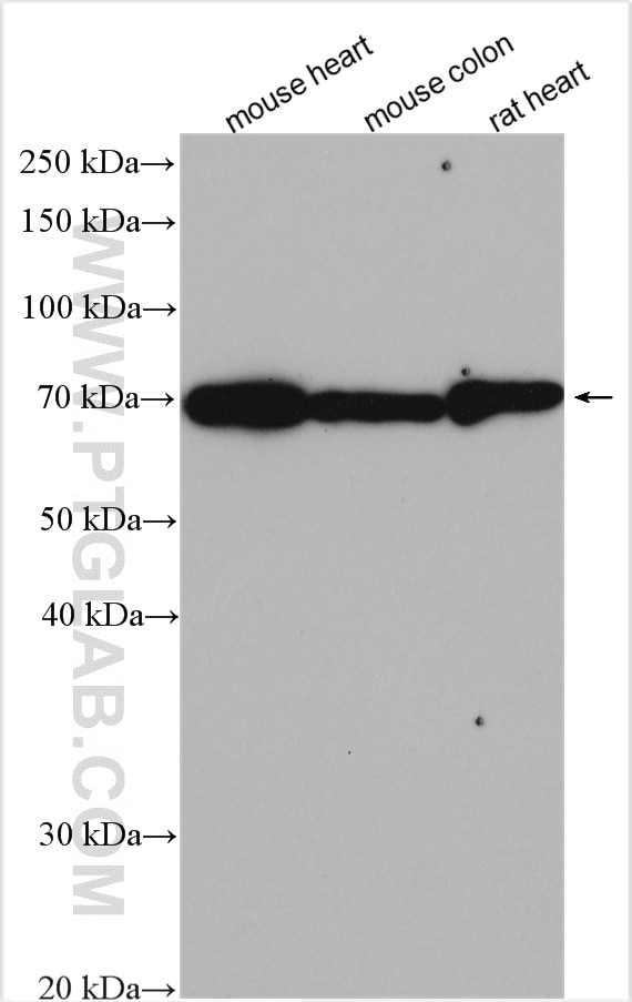 Western Blot (WB) analysis of various lysates using Decorin Polyclonal antibody (14667-1-AP)