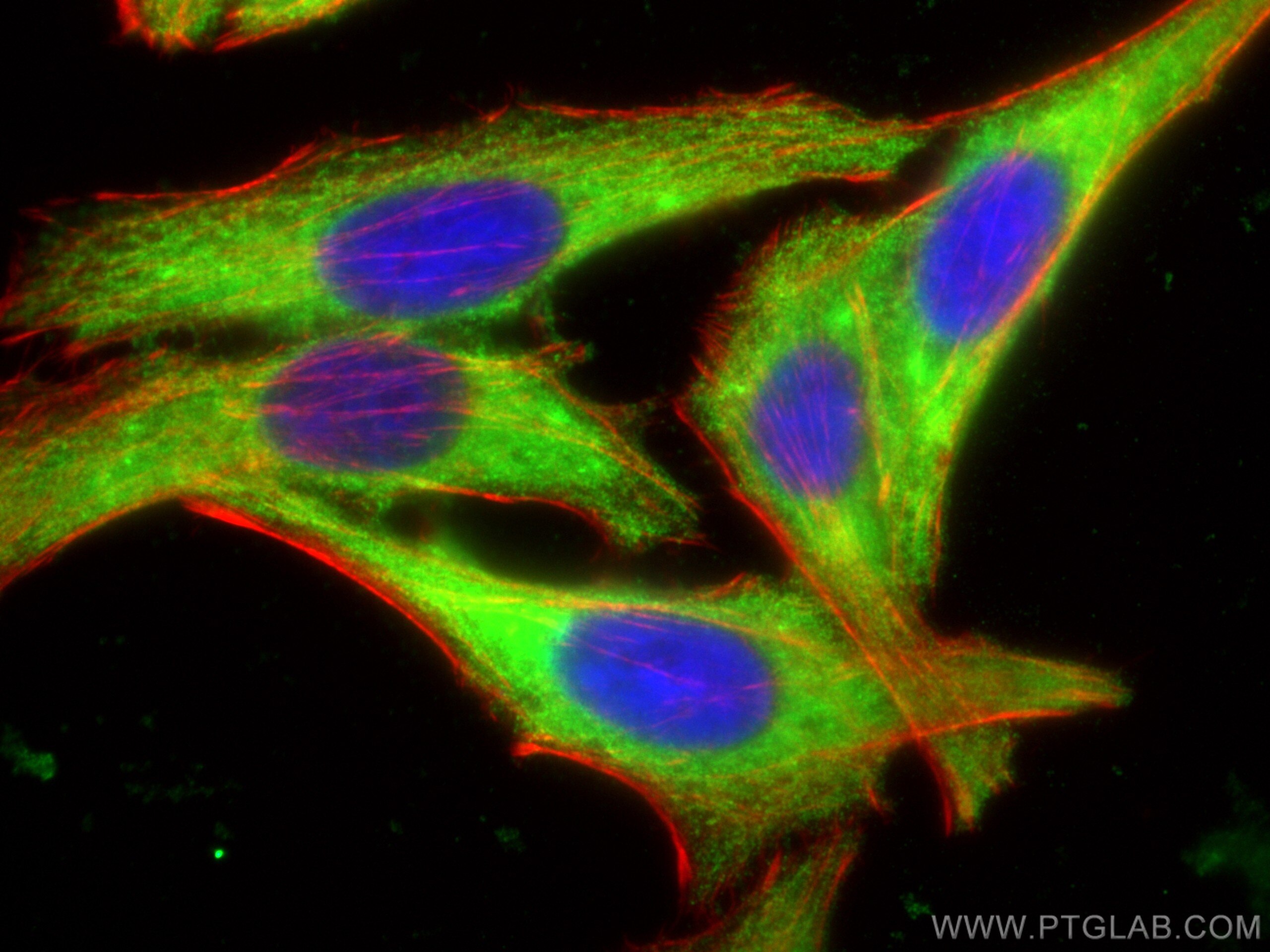 Immunofluorescence (IF) / fluorescent staining of HepG2 cells using DCP1A Polyclonal antibody (22373-1-AP)