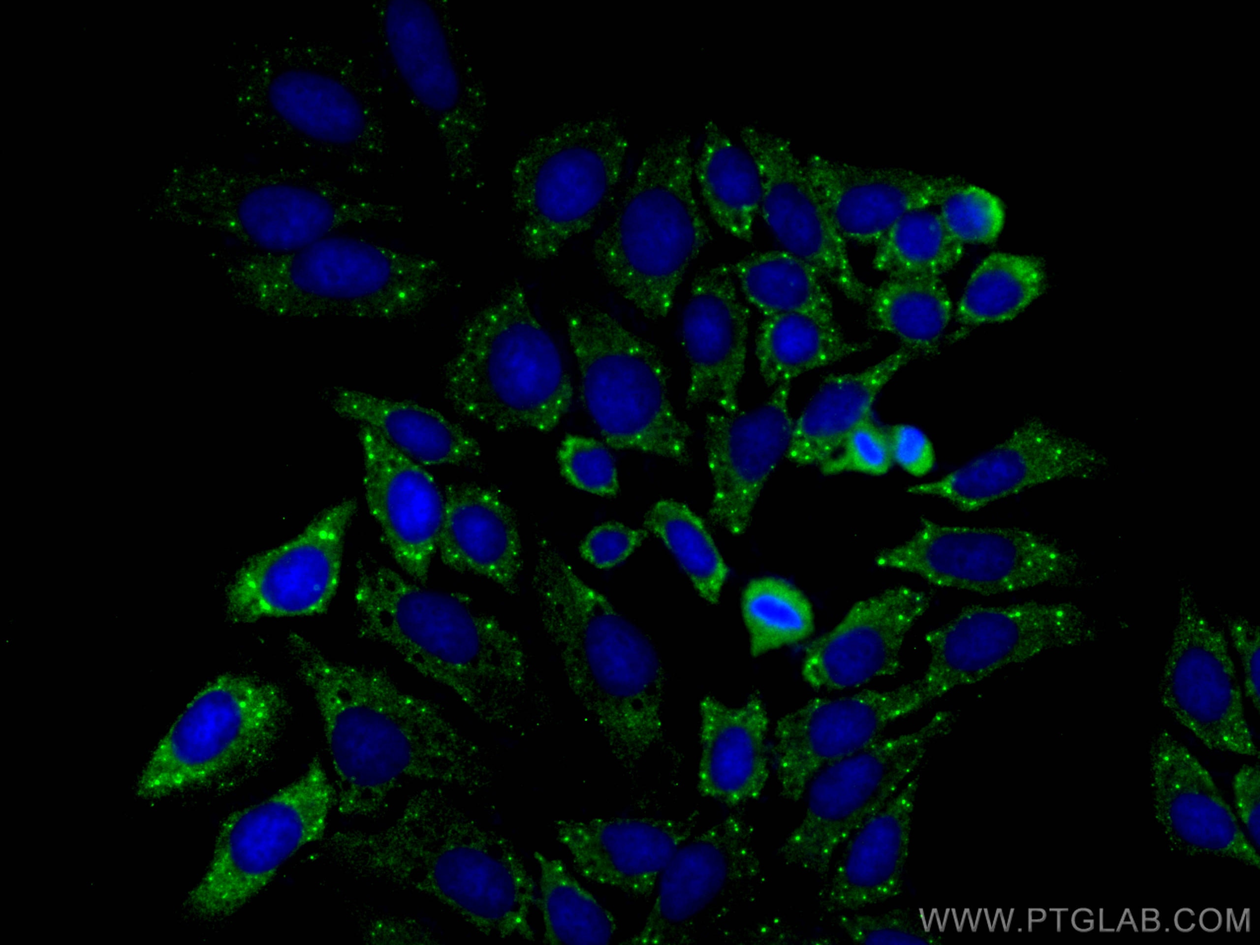 Immunofluorescence (IF) / fluorescent staining of HepG2 cells using DCP1A Polyclonal antibody (22373-1-AP)