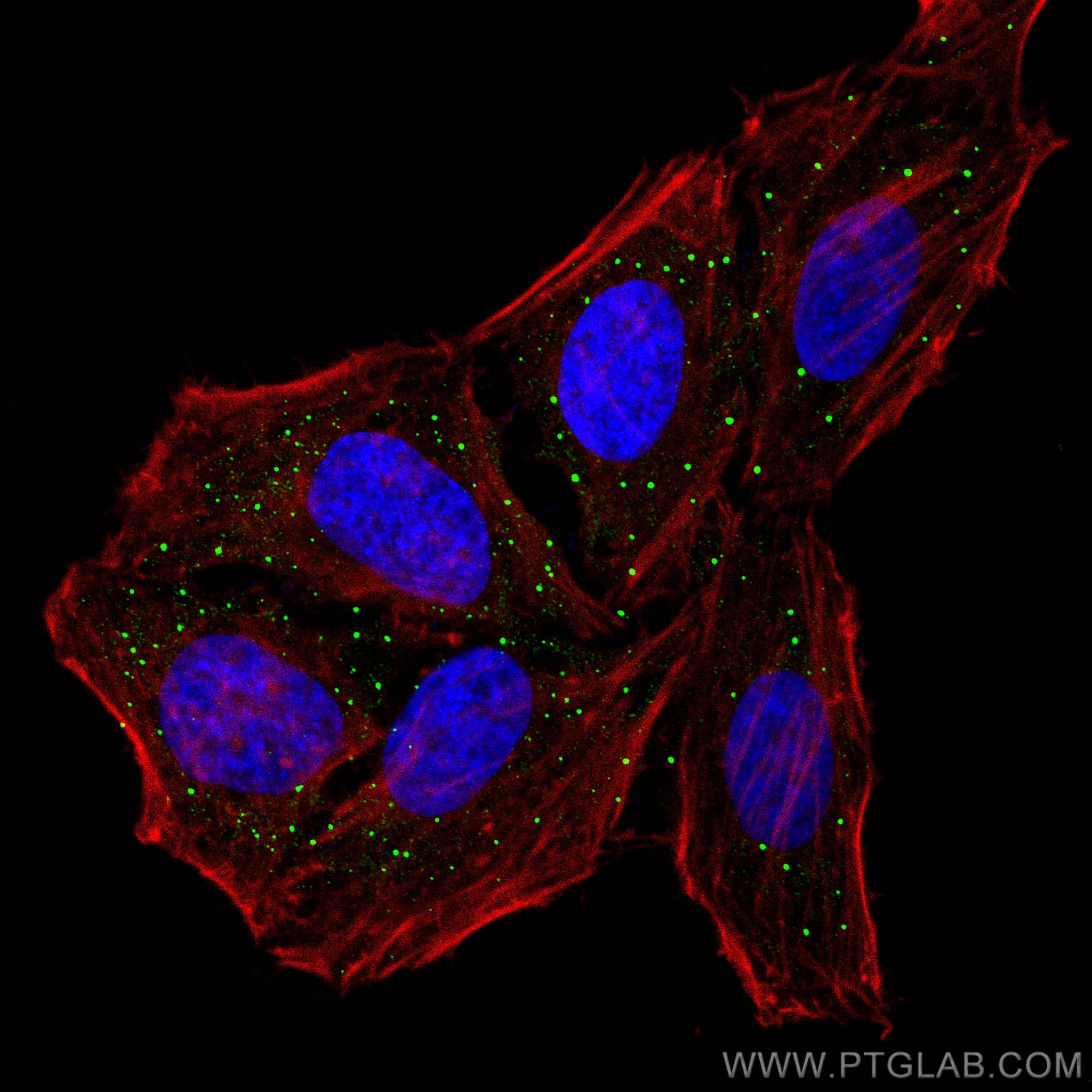 Immunofluorescence (IF) / fluorescent staining of HepG2 cells using DCP1A Polyclonal antibody (22373-1-AP)