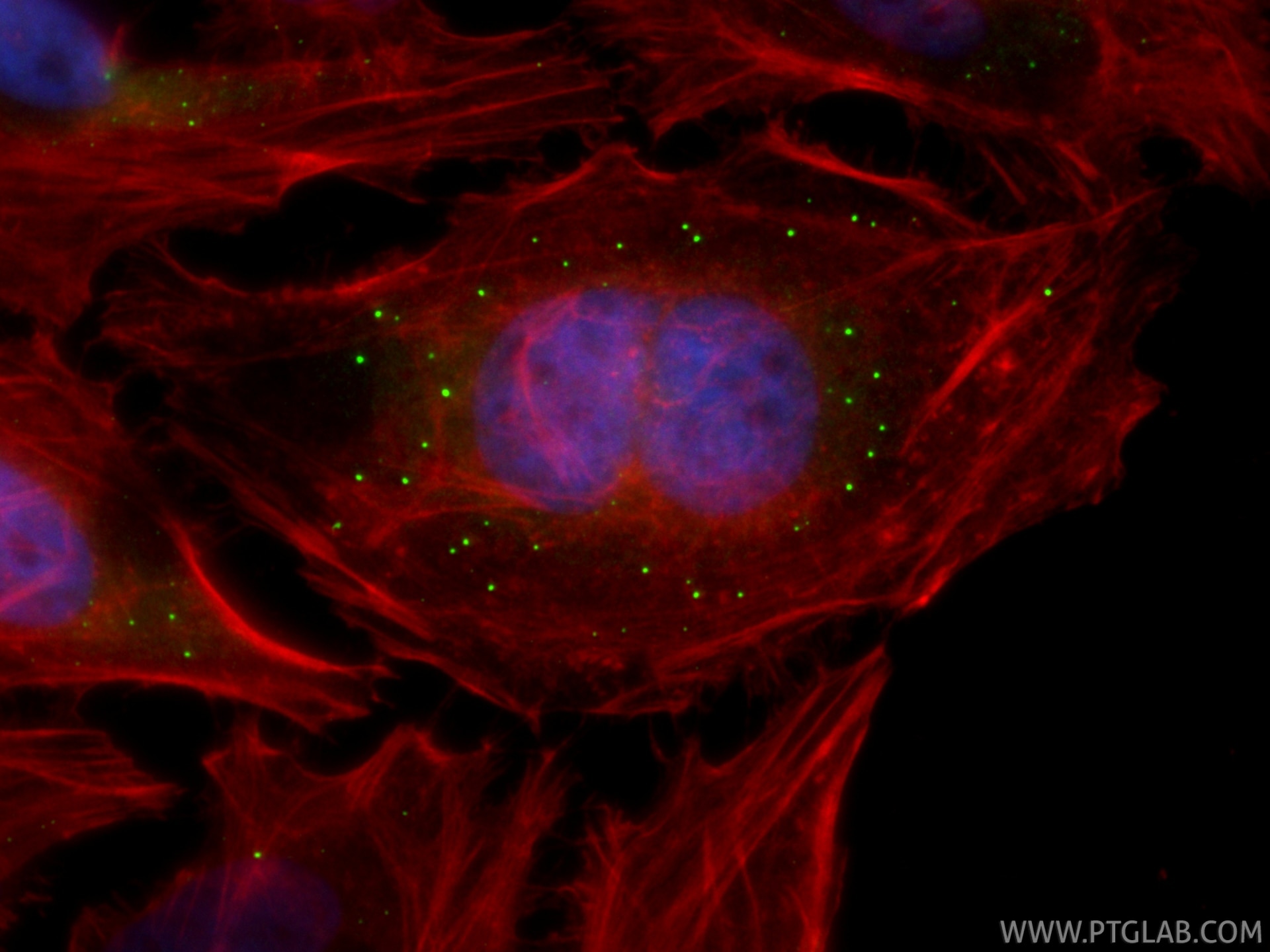 IF Staining of HeLa using 22373-1-AP Immunofluorescence (IF) / fluorescent staining of HeLa cells using DCP1A Polyclonal antibody (22373-1-AP)