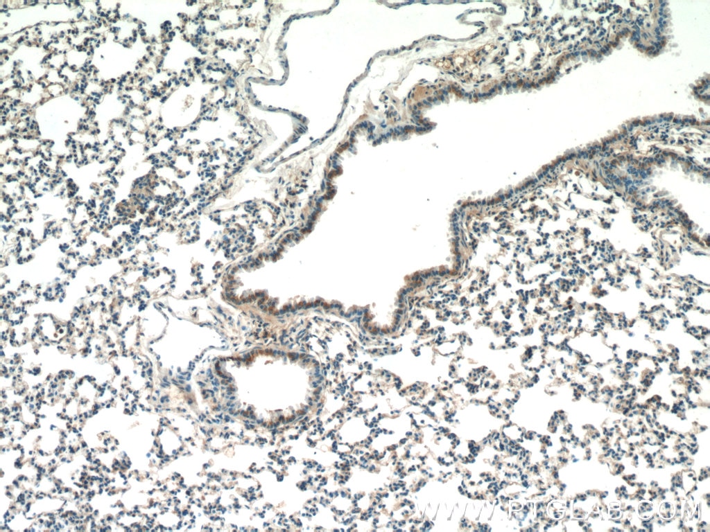 Immunohistochemistry (IHC) staining of mouse lung tissue using DCP1A Polyclonal antibody (22373-1-AP)