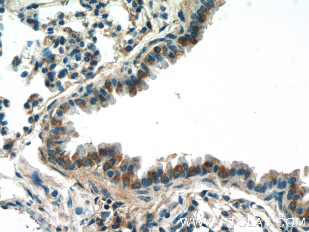 Immunohistochemistry (IHC) staining of mouse lung tissue using DCP1A Polyclonal antibody (22373-1-AP)