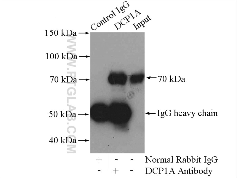 Immunoprecipitation (IP) experiment of mouse brain tissue using DCP1A Polyclonal antibody (22373-1-AP)