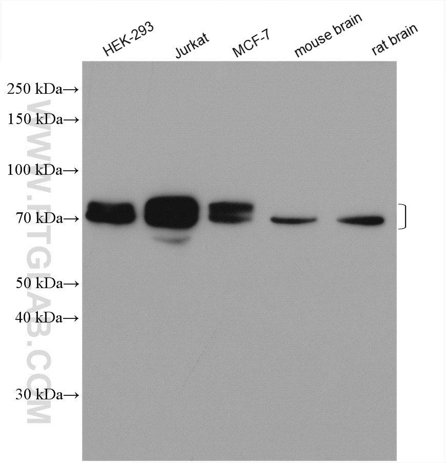 Western Blot (WB) analysis of various lysates using DCP1A Polyclonal antibody (22373-1-AP)