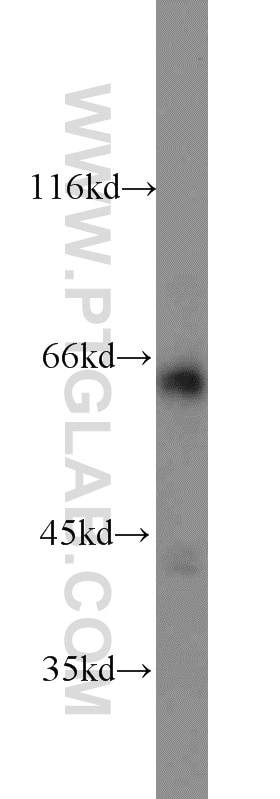 Western Blot (WB) analysis of mouse brain tissue using DCP1A Polyclonal antibody (22373-1-AP)