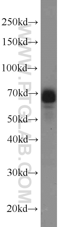 Western Blot (WB) analysis of Jurkat cells using DCP1A Polyclonal antibody (22373-1-AP)