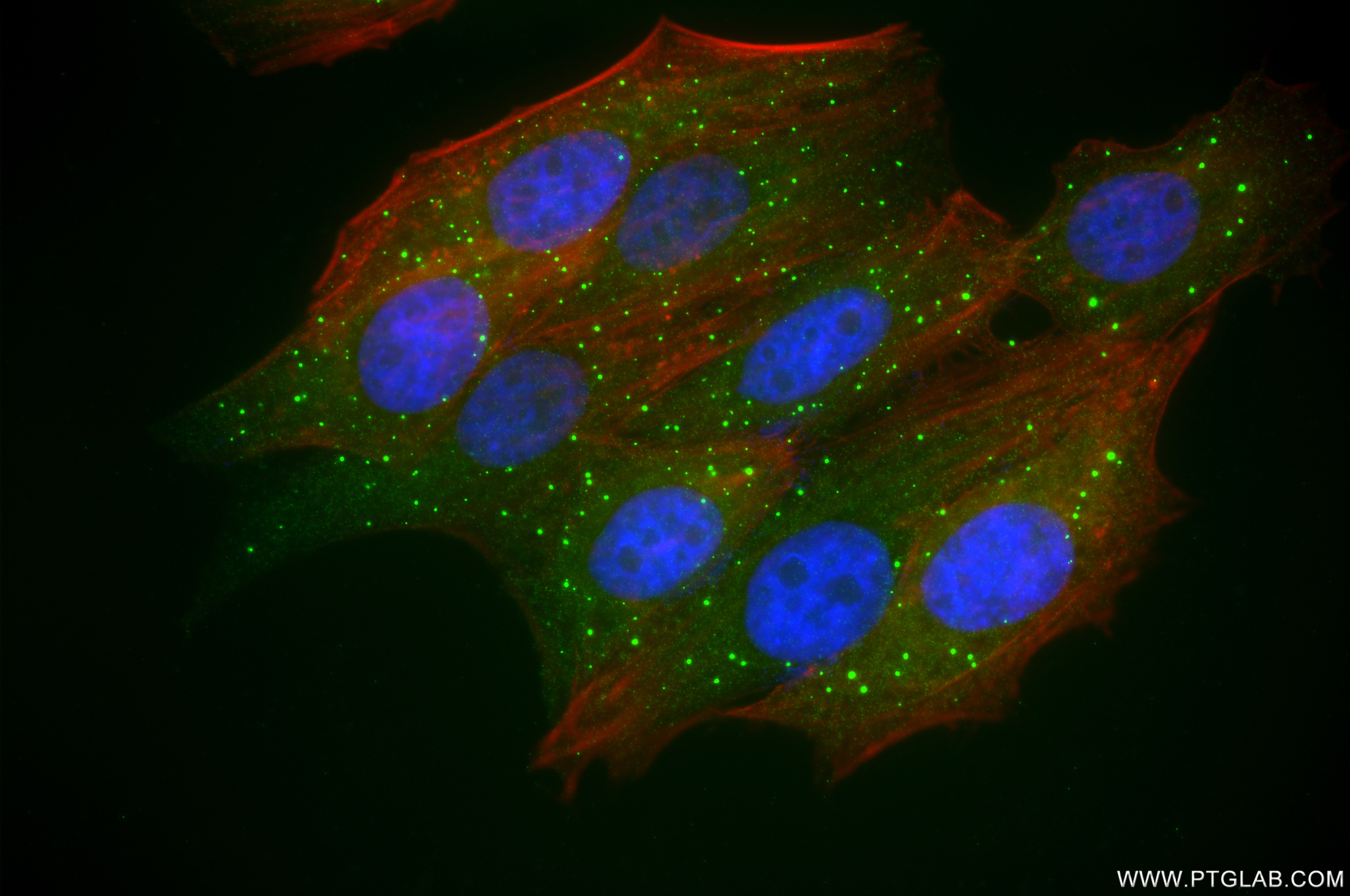 Immunofluorescence (IF) / fluorescent staining of HepG2 cells using DCP1A Recombinant antibody (85047-5-RR)