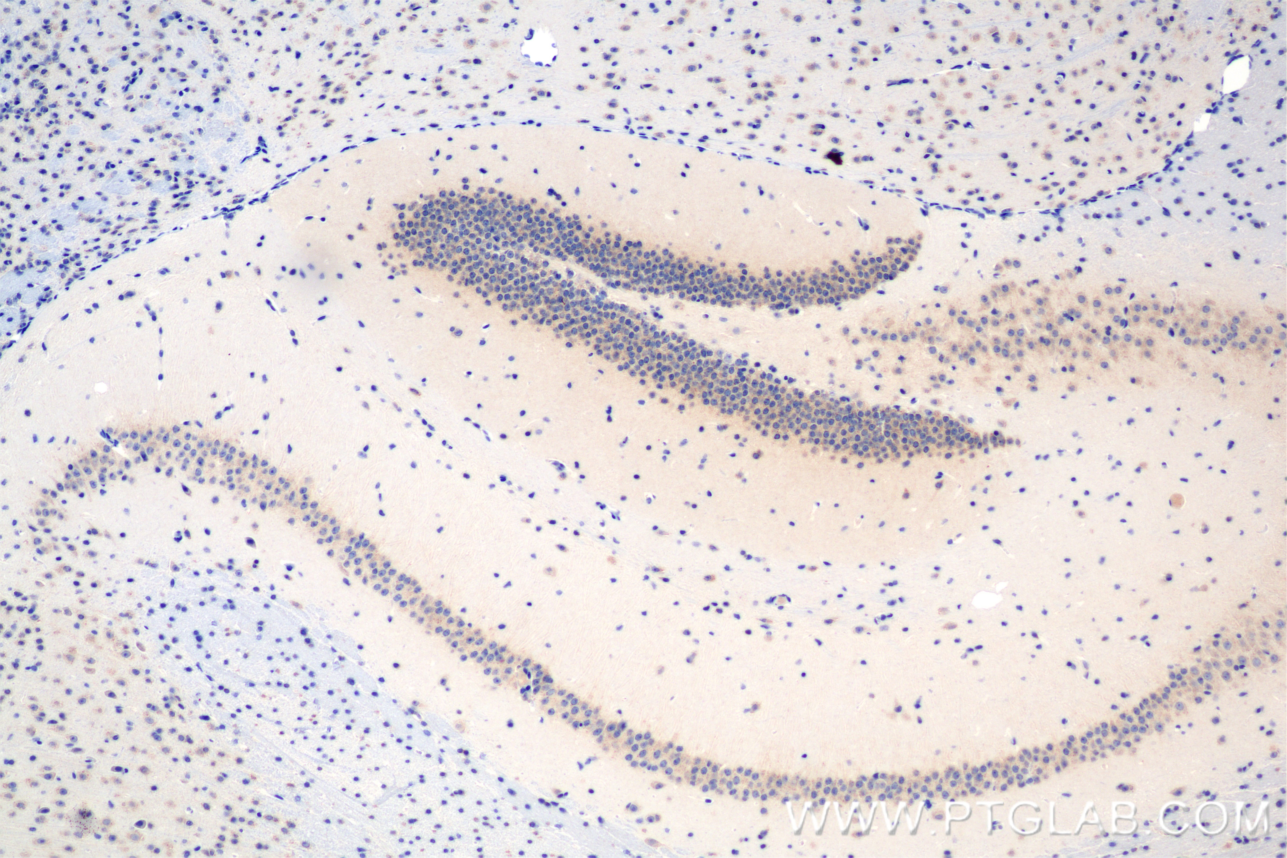 Immunohistochemistry (IHC) staining of mouse brain tissue using DCP1A Recombinant antibody (85047-5-RR)