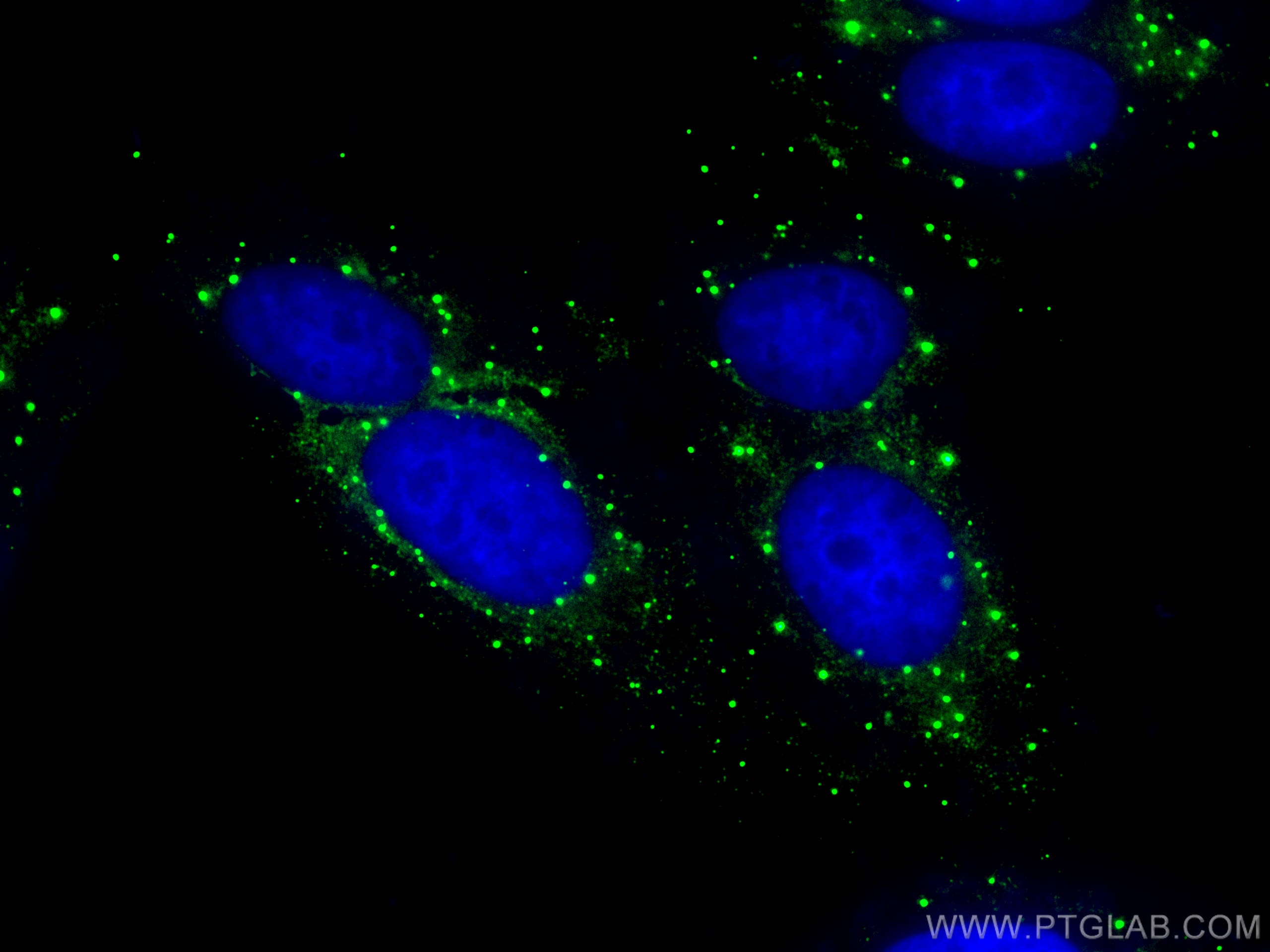 Immunofluorescence (IF) / fluorescent staining of HepG2 cells using CoraLite® Plus 488-conjugated DCP1A Polyclonal ant (CL488-22373)
