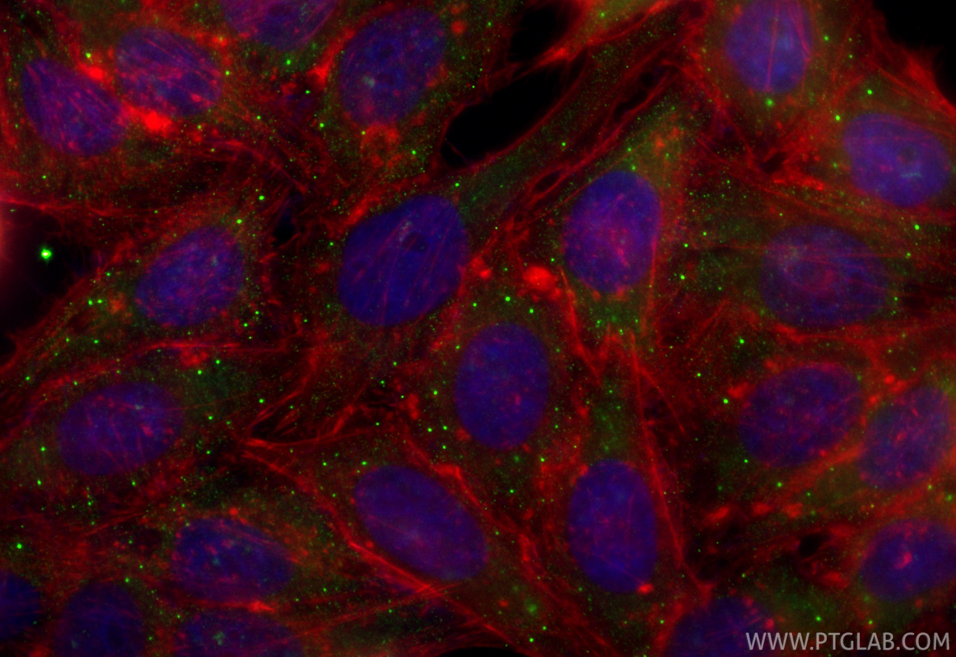 Immunofluorescence (IF) / fluorescent staining of HepG2 cells using CoraLite® Plus 488-conjugated DCP1A Recombinant an (CL488-85047-5)