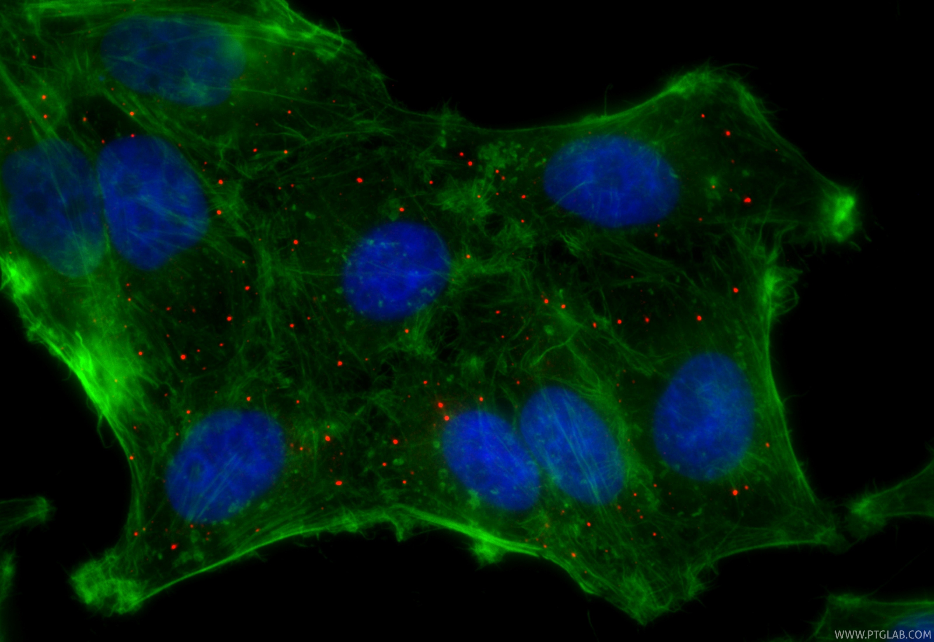 Immunofluorescence (IF) / fluorescent staining of HepG2 cells using CoraLite®594-conjugated DCP1A Recombinant monoclon (CL594-85047-5)