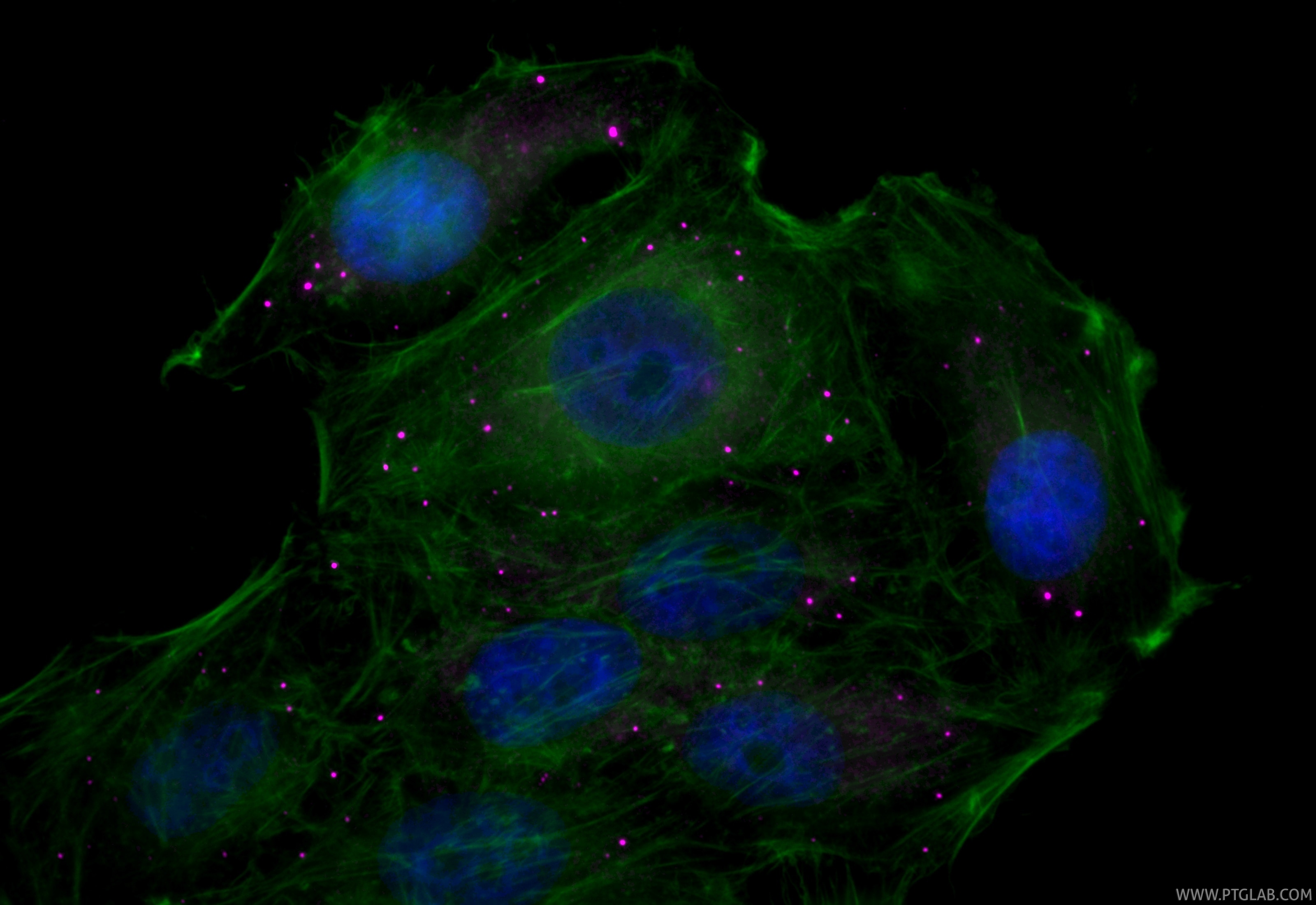 Immunofluorescence (IF) / fluorescent staining of HepG2 cells using CoraLite® Plus 647-conjugated DCP1A Recombinant mo (CL647-85047-5)