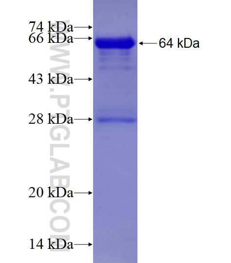 DCP1A fusion protein Ag18027 SDS-PAGE
