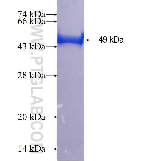 DCP1A fusion protein Ag18706 SDS-PAGE