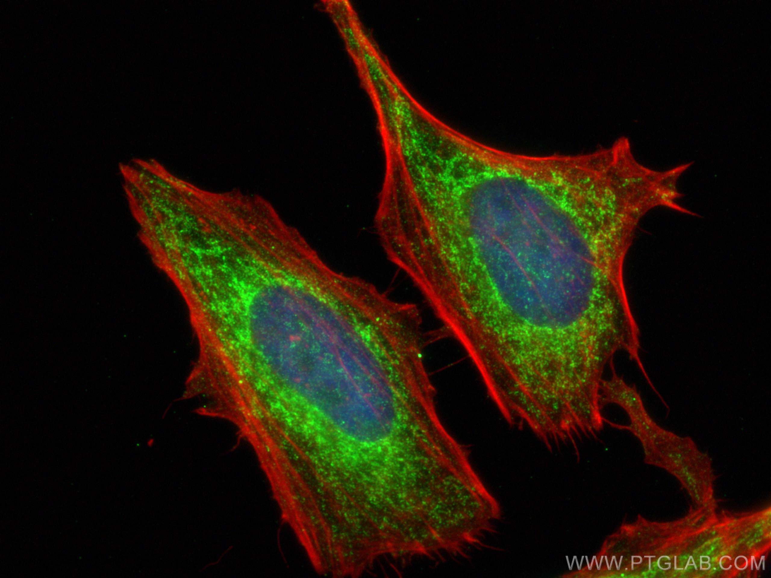 Immunofluorescence (IF) / fluorescent staining of HeLa cells using DCP1B Polyclonal antibody (13863-1-AP)