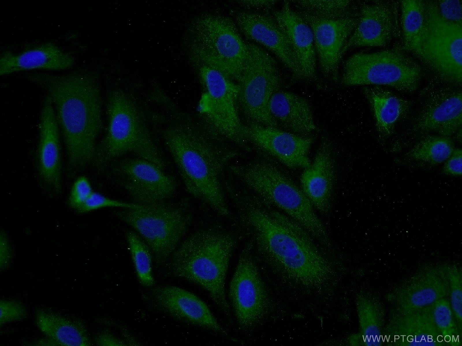 Immunofluorescence (IF) / fluorescent staining of A549 cells using DCP1B Polyclonal antibody (13863-1-AP)