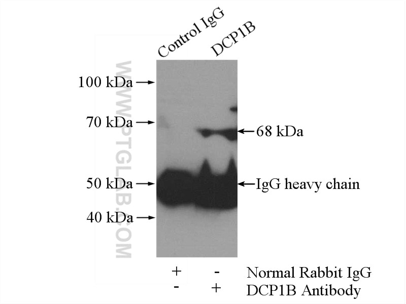 Immunoprecipitation (IP) experiment of HeLa cells using DCP1B Polyclonal antibody (13863-1-AP)