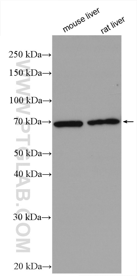 Western Blot (WB) analysis of various lysates using DCP1B Polyclonal antibody (13863-1-AP)