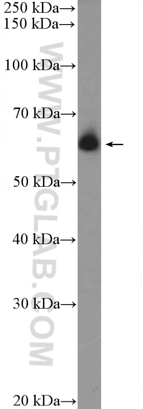 Western Blot (WB) analysis of rat spleen tissue using DCP1B Polyclonal antibody (13863-1-AP)