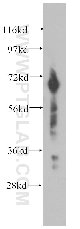 DCP1B