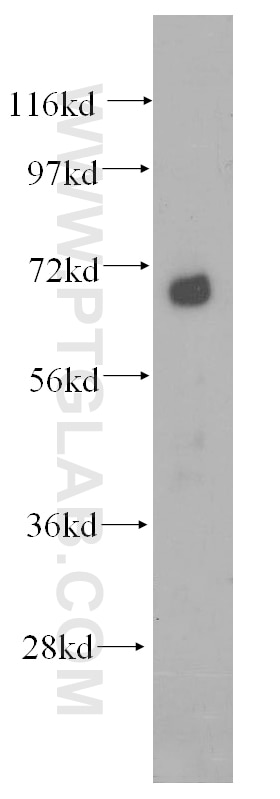 Western Blot (WB) analysis of human liver tissue using DCP1B Polyclonal antibody (13863-1-AP)