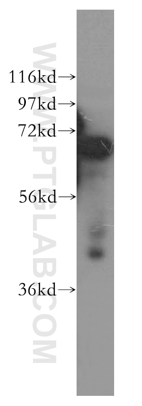 Western Blot (WB) analysis of HeLa cells using DCP1B Polyclonal antibody (13863-1-AP)