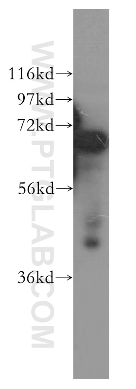 WB analysis of HeLa using 13863-1-AP