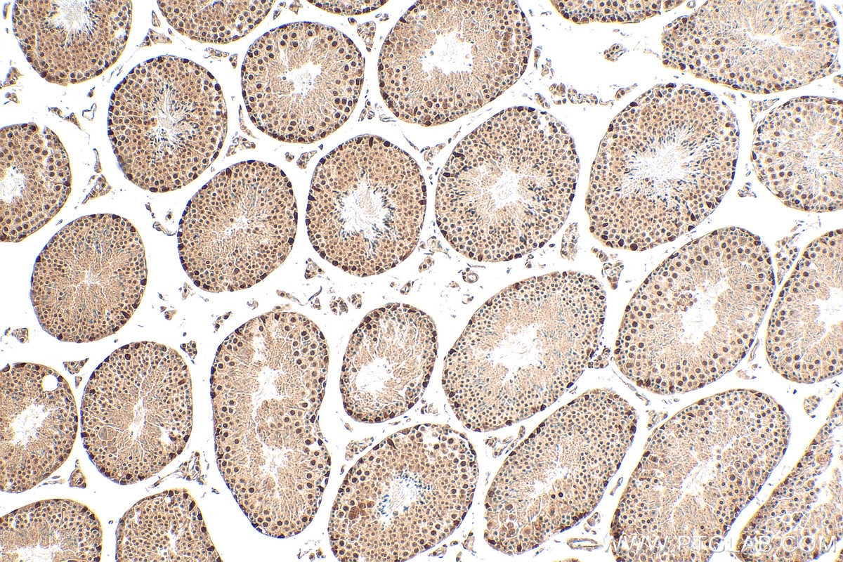 Immunohistochemistry (IHC) staining of mouse testis tissue using DCPS Polyclonal antibody (28465-1-AP)