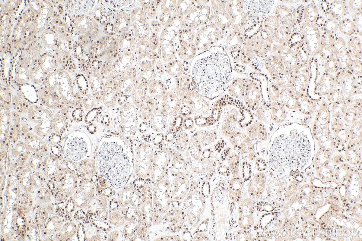 Immunohistochemistry (IHC) staining of human kidney tissue using DCPS Polyclonal antibody (28465-1-AP)
