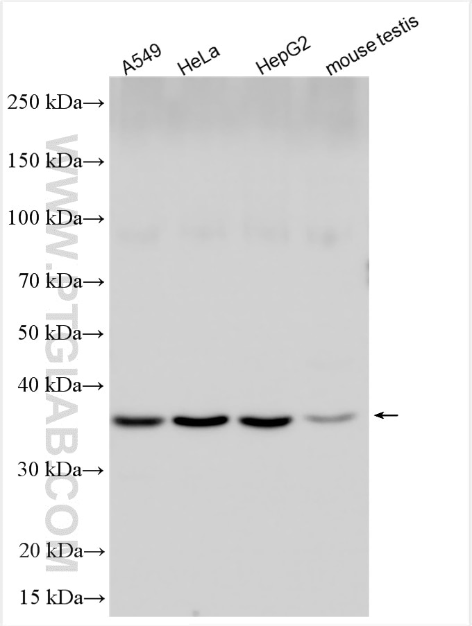 Western Blot (WB) analysis of various lysates using DCPS Polyclonal antibody (28465-1-AP)