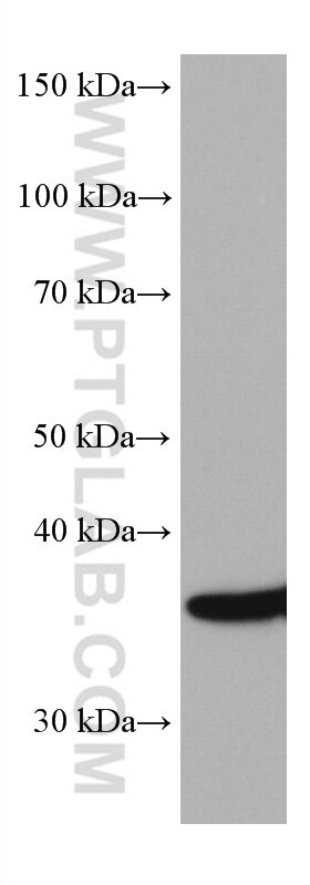 WB analysis of rat spleen using 67311-1-Ig