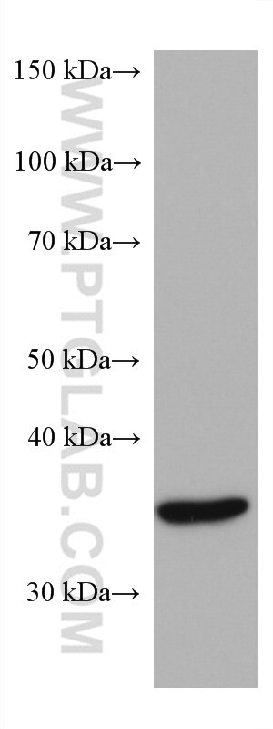 Western Blot (WB) analysis of mouse brain tissue using DCPS Monoclonal antibody (67311-1-Ig)