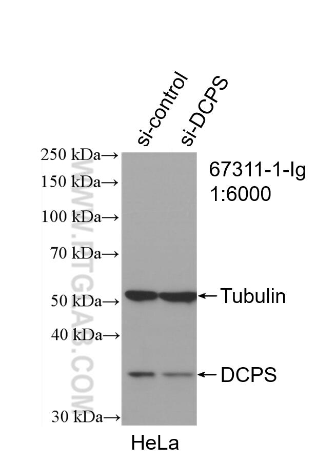 Western Blot (WB) analysis of HeLa cells using DCPS Monoclonal antibody (67311-1-Ig)
