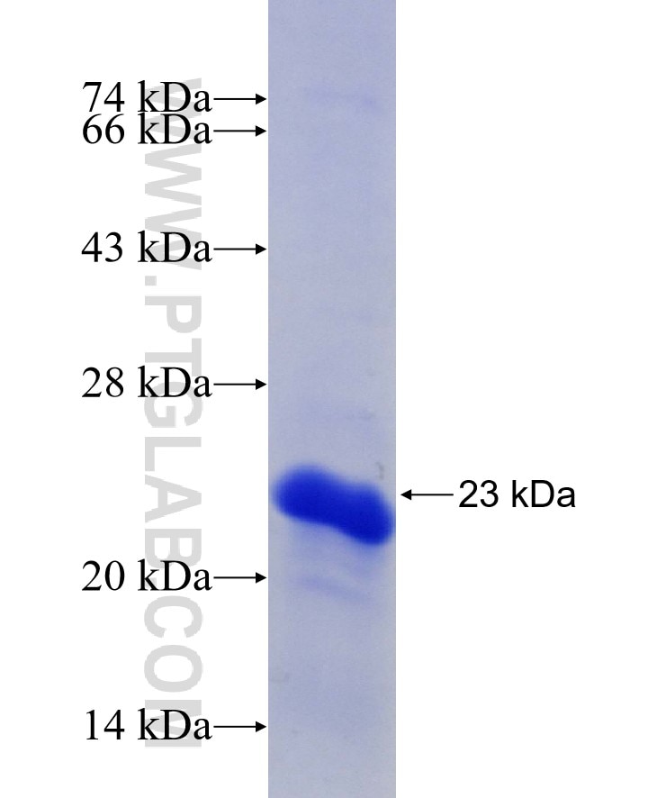 DCPS fusion protein Ag29493 SDS-PAGE DCPS fusion protein Ag29493 SDS-PAGE